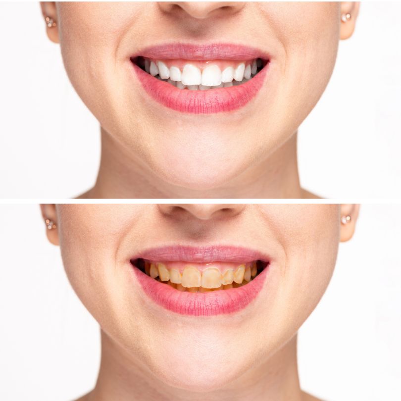 estética dental