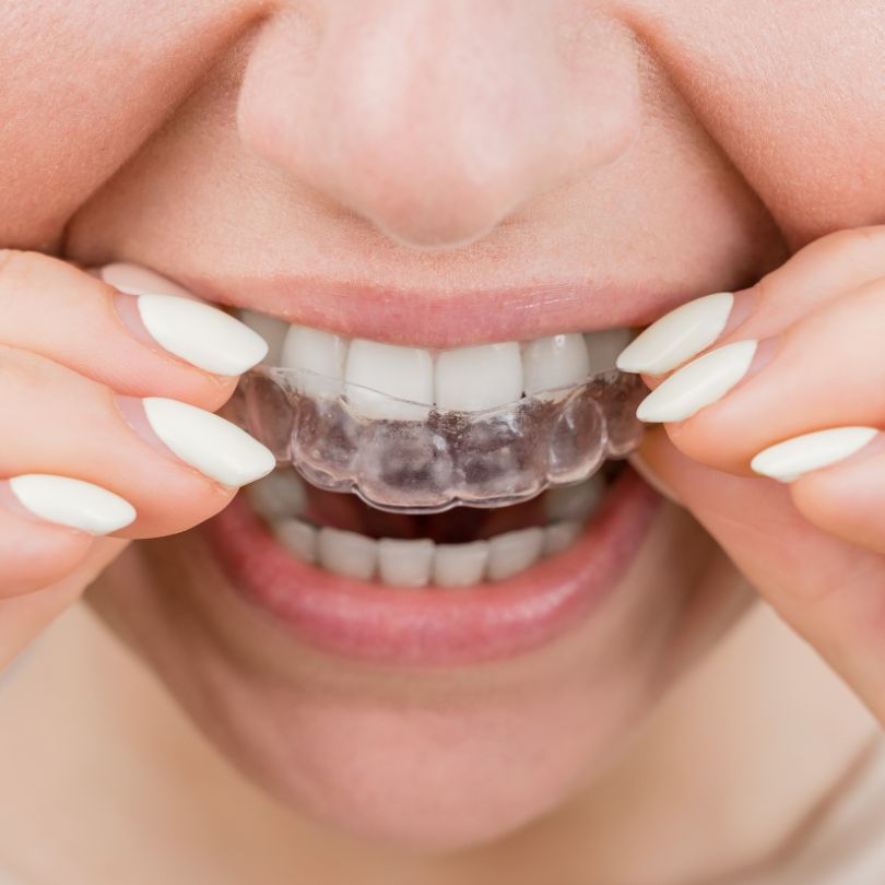 estética dental