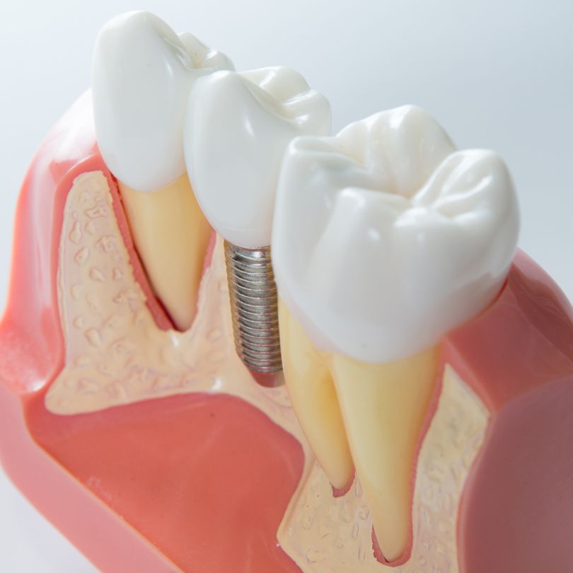 estética dental