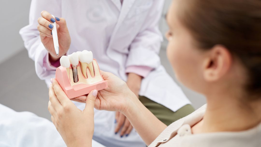Implantes dentales