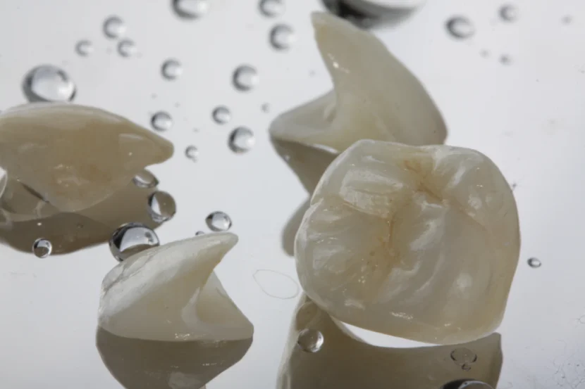 Prótesis dentales en Cullera Valencia